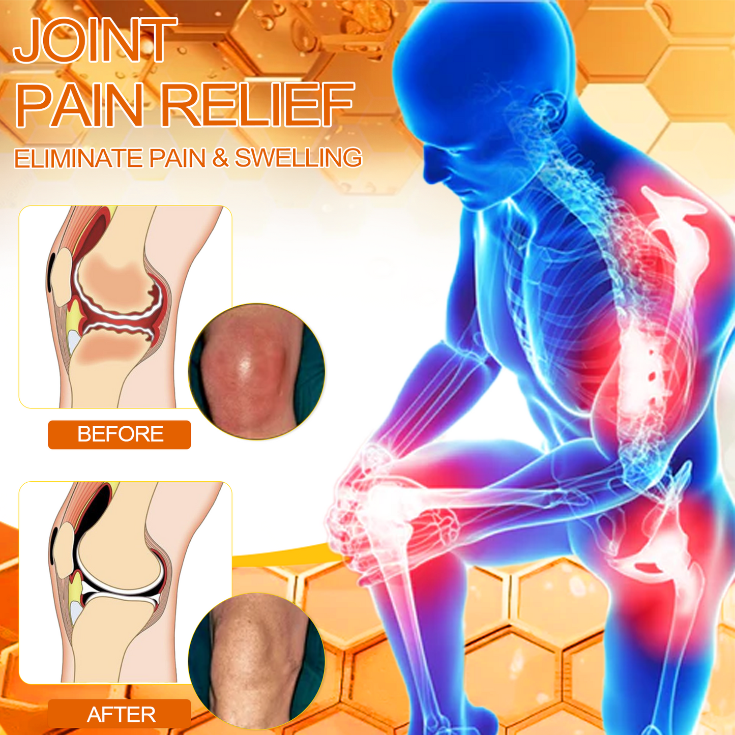 Official Store: ๐ฆตVLSVLSโข Bee Venom Arthritis Therapy Cream(Specially for older adults & AAOS recommends)๐ฅ๐ณ๐๐๐ ๐
๐๐ ๐๐๐๐๐๐๐๐๐ 7๐% ๐๐๐