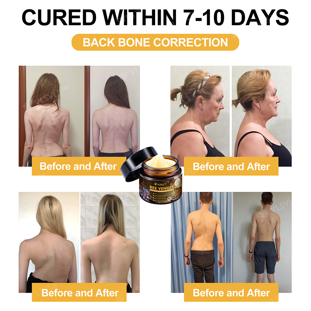 Official Store: ๐ฆตVLSVLSโข Bee Venom Arthritis Therapy Cream(Specially for older adults & AAOS recommends)๐ฅ๐ณ๐๐๐ ๐
๐๐ ๐๐๐๐๐๐๐๐๐ 7๐% ๐๐๐