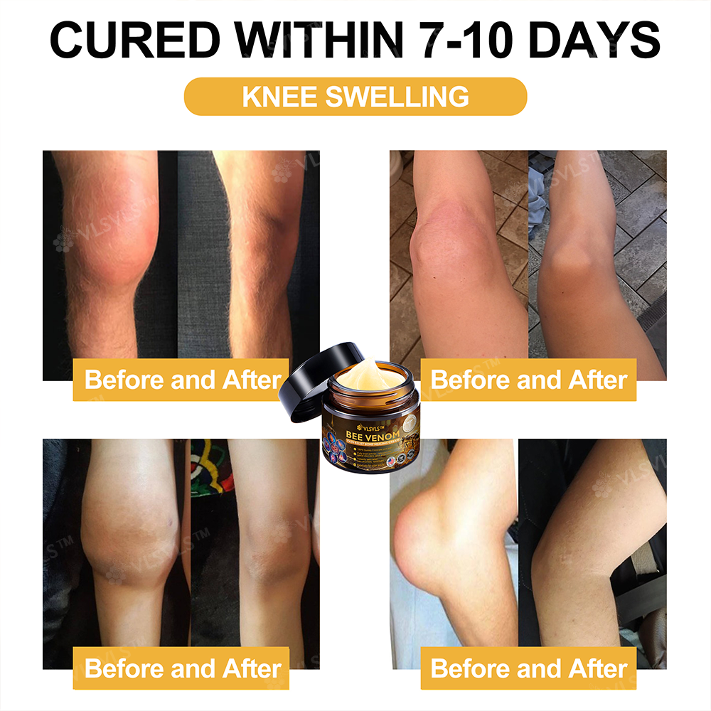 Official Store: ๐ฆตVLSVLSโข Bee Venom Arthritis Therapy Cream(Specially for older adults & AAOS recommends)๐ฅ๐ณ๐๐๐ ๐
๐๐ ๐๐๐๐๐๐๐๐๐ 7๐% ๐๐๐